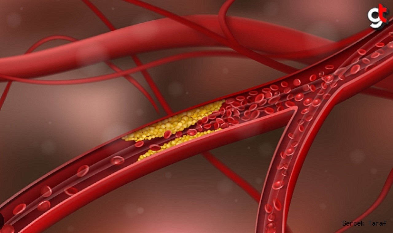 Damar Sertliği Neden Olur? Nelere Dikkat Edilmeli? Nelerden Uzak Durulmalı?
