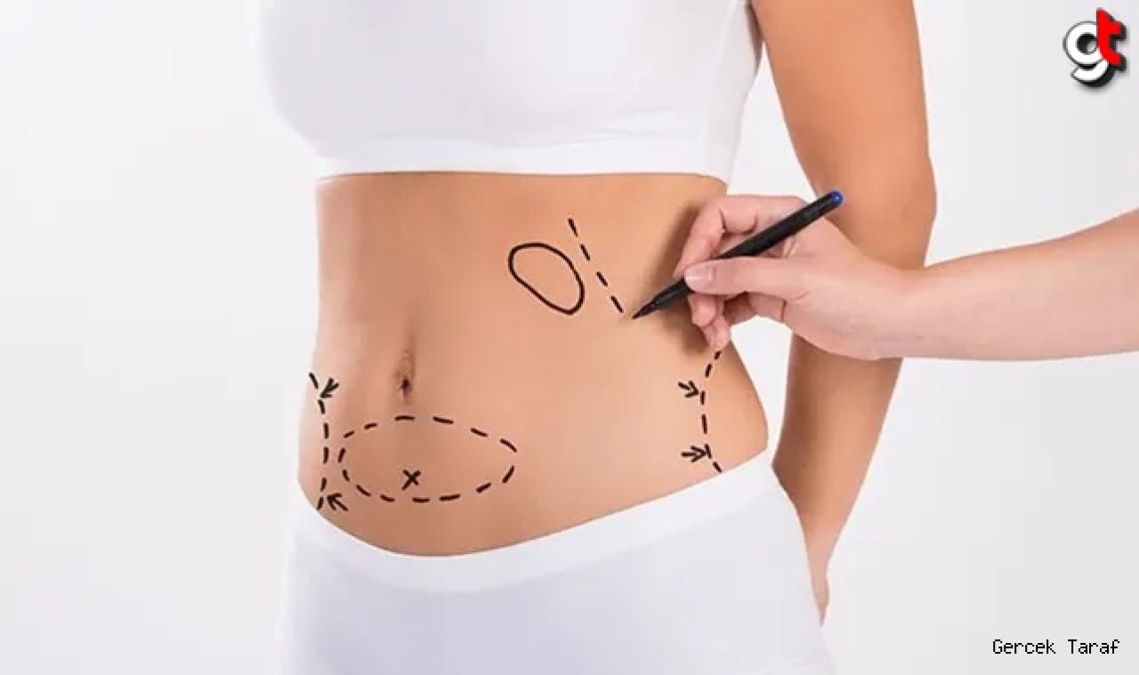 Liposuction nedir, kimler yaptırabilir, nasıl uygulanır?