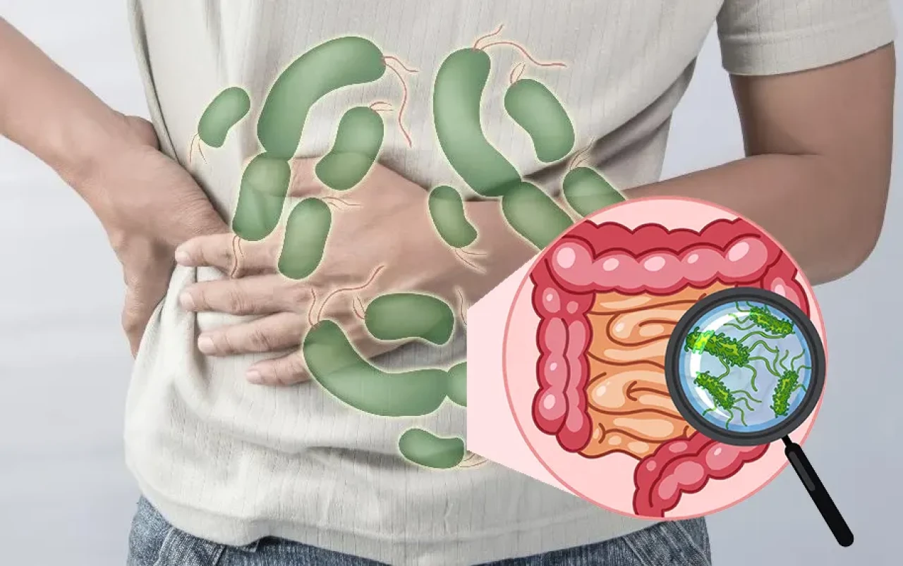 Salmonella Virüsü Nedir? Belirtileri, Nasıl Bulaşır, Tedavisi Nasıl?