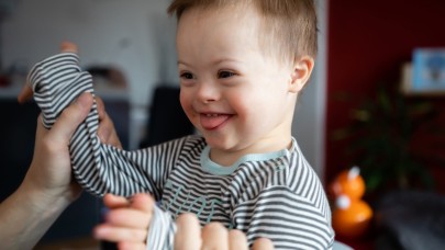 Ensesi Kalın Olan Her Bebek Down Sendromlu mu Doğar?