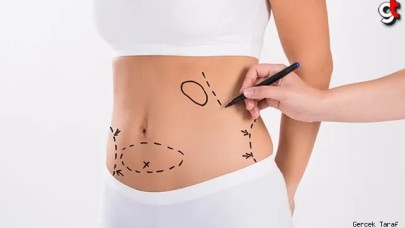 Liposuction nedir, kimler yaptırabilir, nasıl uygulanır?