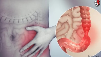 45 yaş altı gençlerin kabusu: Huzursuz Bağırsak Sendromu İrritabl!