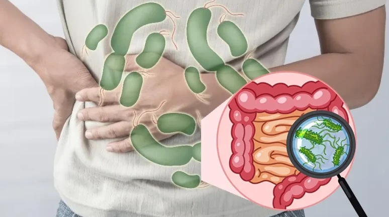 Salmonella Virüsü Nedir? Belirtileri, Nasıl Bulaşır, Tedavisi Nasıl?