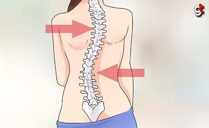 Omurga eğriliği skolyoz nedir, nasıl tedavi edilir?