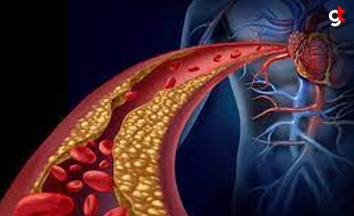 Yüksek Kolesterol Nedir? Kolesterol Hastaları Nasıl Beslenmeli?
