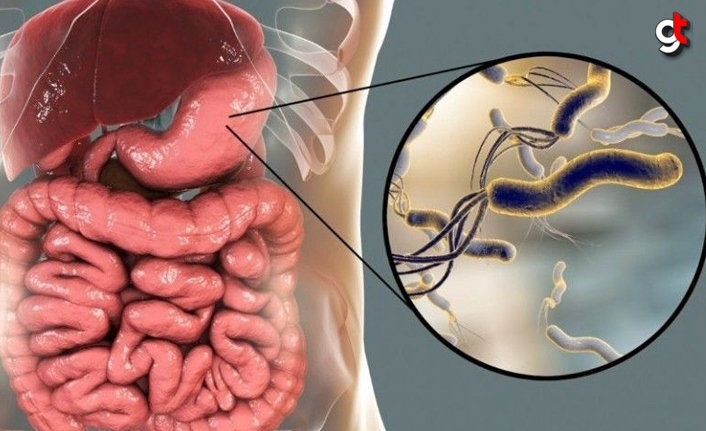 Helikobakter Pilori Nedir?  Nelere Dikkat Edilmeli?