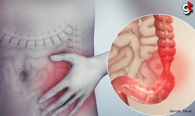 45 yaş altı gençlerin kabusu: Huzursuz Bağırsak Sendromu İrritabl!